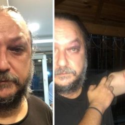 BirGün gazetesi yazarı Güvenç Dağüstün saldırıya uğradı