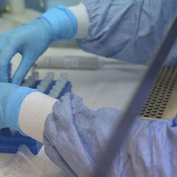 Doç. Dr. Ümit Savaşçı: Koronavirüs temaslılarına PCR testi en erken 3 gün sonra yapılmalı