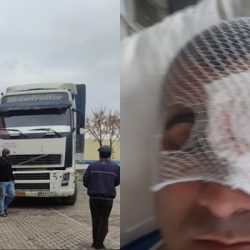 TIR'lar soyuluyor, şoförler saldırıya uğruyor: Türkiyeli TIR şoförü sol gözünü kaybetti